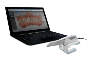 CS 3600 intraoral scanner